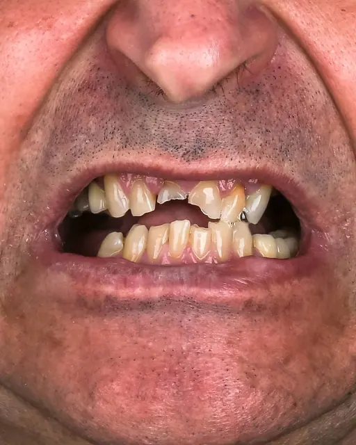 Before treatment