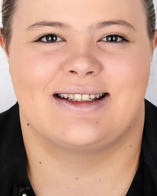 Before treatment