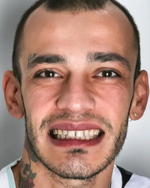 Before treatment