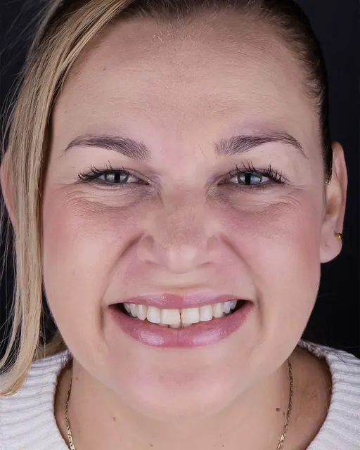 Before treatment