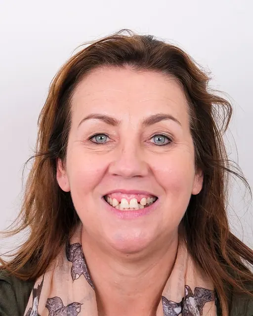 Before treatment