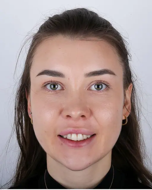 Before treatment