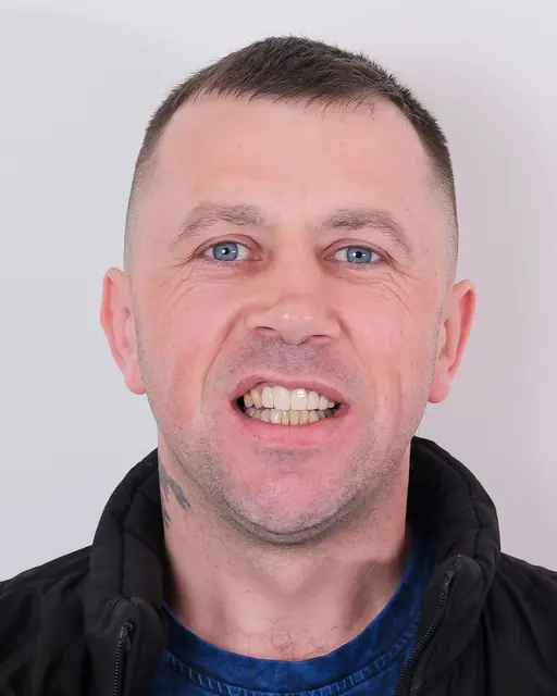 Before treatment