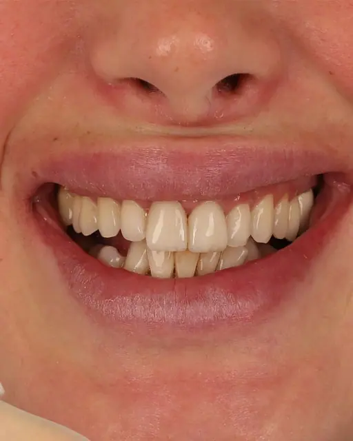 Before treatment