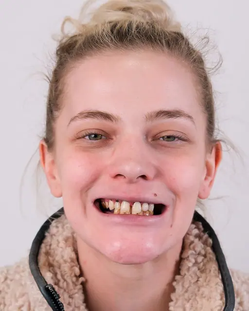 Before treatment