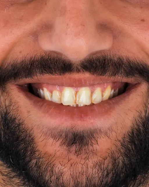 Before treatment