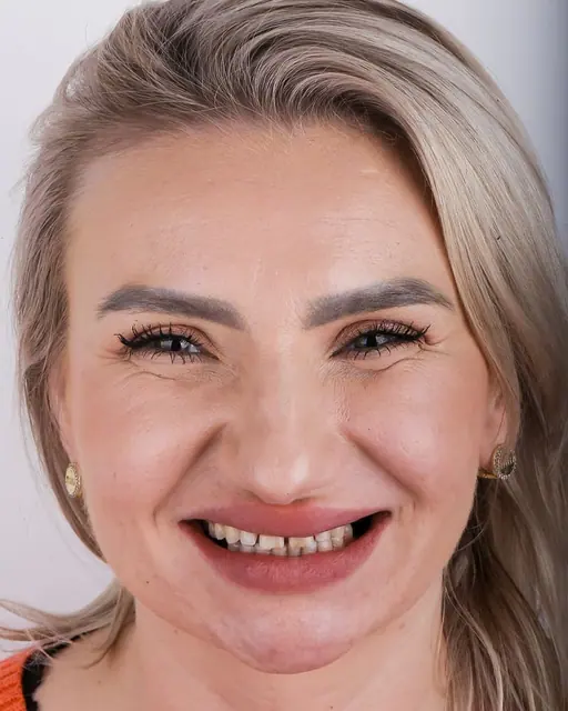 Before treatment